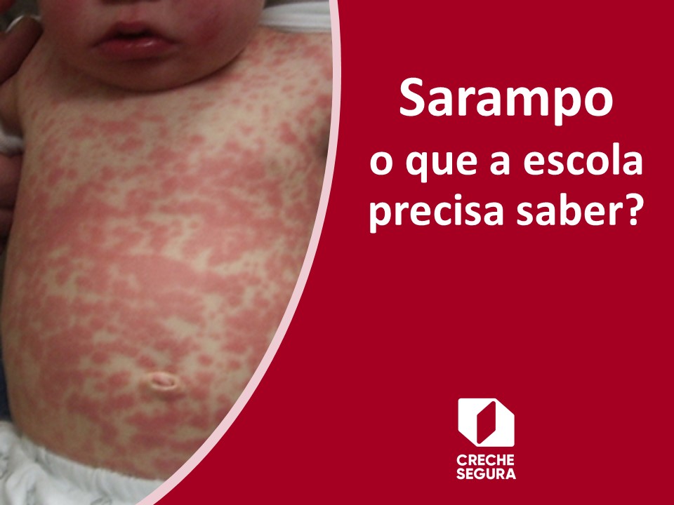 PDF) Avaliação do sistema de vigilância epidemiológica do sarampo